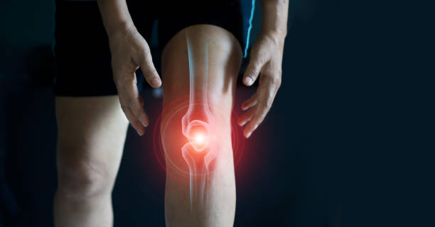 Las molestias de rodilla son muy comunes.