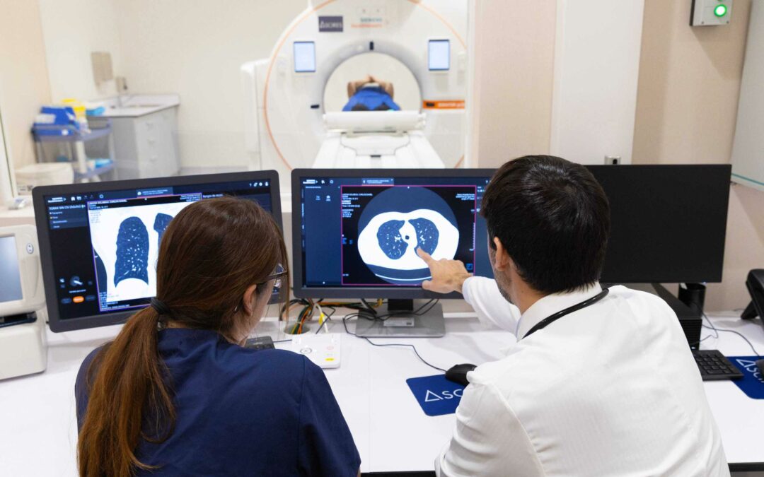 Detección precoz del cáncer de pulmón: cómo un TAC anual puede salvar vidas